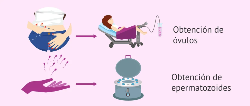 Cambios en la dinámica relacional Terapia de pareja y donación de esperma