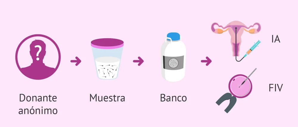 Terapia de pareja y donación de esperma Cómo manejar el estrés